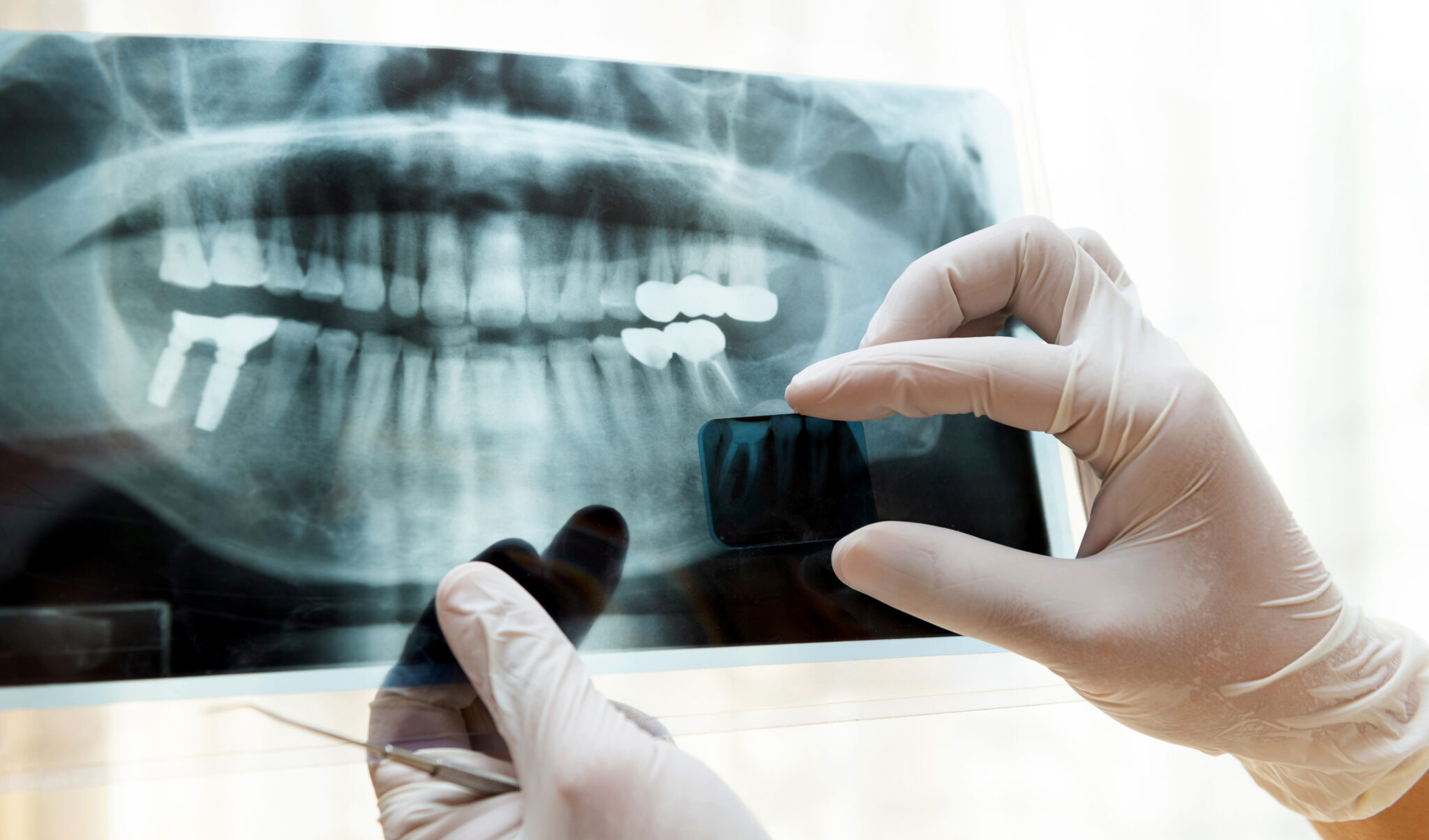 Emergency Relief For Your Sudden Toothache | Prairie Village, KS