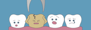 Prairie Village, KS, dentist offers tooth extractions