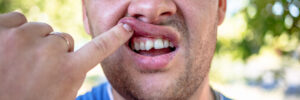 prairie village dental emergency