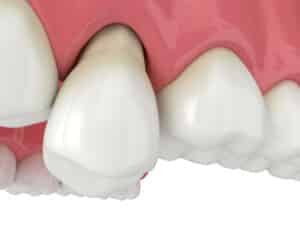 prairie village loose tooth
