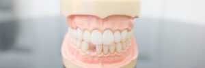 prairie village knocked out teeth