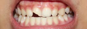 prairie village dental emergency