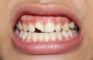 prairie village dental emergency