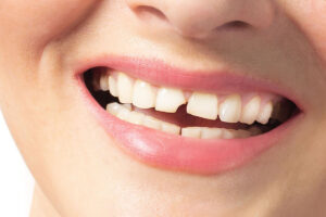prairie village dental emergency