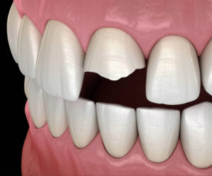 prairie village dental emergency