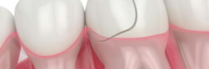 prairie village dental emergency