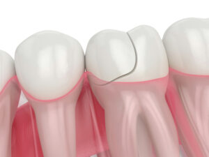 prairie village dental emergency