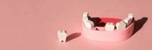 prairie village knocked-out teeth